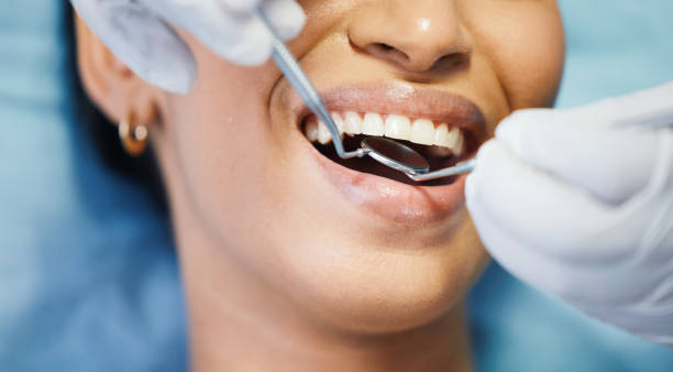 Best Emergency Treatment for Dental Infections or Abscesses in Olympia Heights, FL