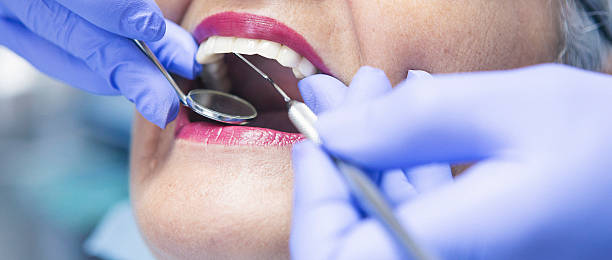 Best Weekend Emergency Dentist in Olympia Heights, FL